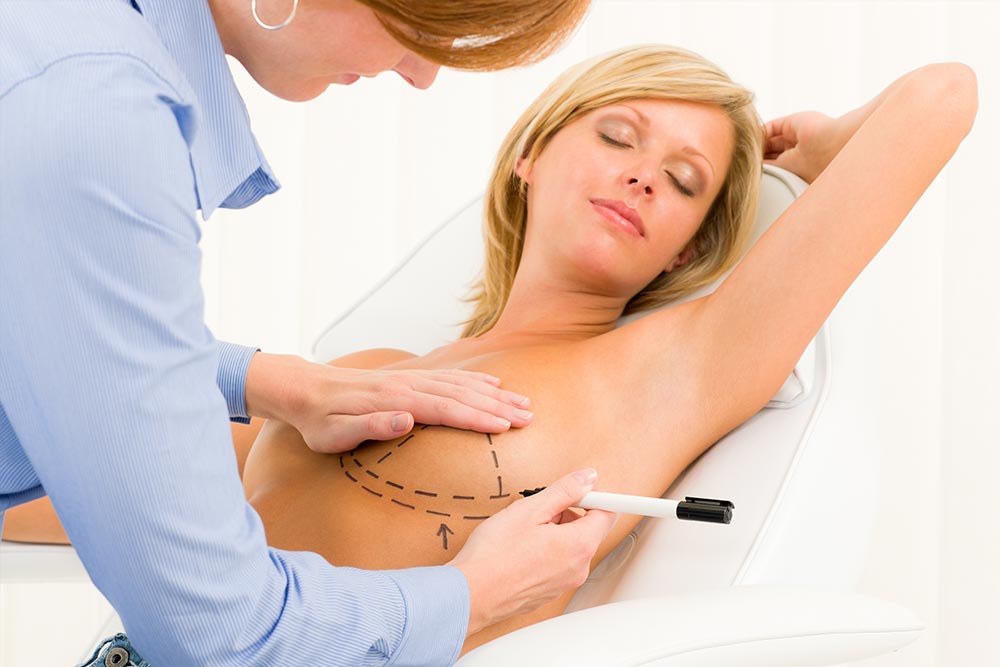 breast-augmentation-sydney